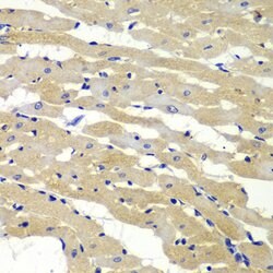 BAK1 Polyclonal Antibody, Invitrogen 100 &mu;L; Unconjugated:Antibodies,