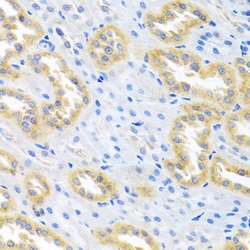 Invitrogen BMP3 Polyclonal Antibody 100 &mu;L; Unconjugated:Antibodies,