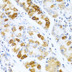 Invitrogen BMP3 Polyclonal Antibody 100 &mu;L; Unconjugated:Antibodies,