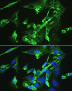 Invitrogen BMPR2 Polyclonal Antibody 100 &mu;L; Unconjugated:Antibodies,