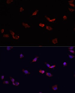 Invitrogen BMPR2 Polyclonal Antibody 100 &mu;L; Unconjugated:Antibodies,