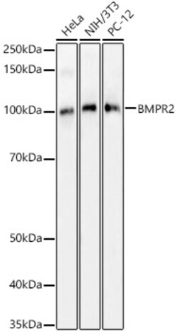 Invitrogen BMPR2 Polyclonal Antibody 100 &mu;L; Unconjugated:Antibodies,