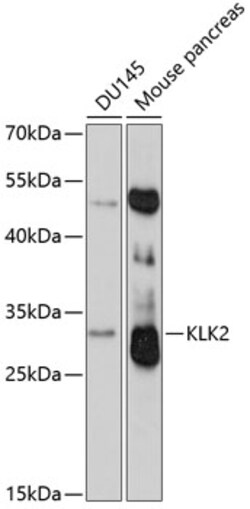Invitrogen Kallikrein 2 Polyclonal Antibody 100 μL; Unconjugated:Antibodies,