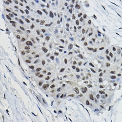 BRAP Polyclonal Antibody:Antibodies, Polyclonal