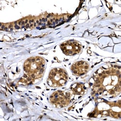 Invitrogen BTRC Polyclonal Antibody 100 &mu;L; Unconjugated:Antibodies,