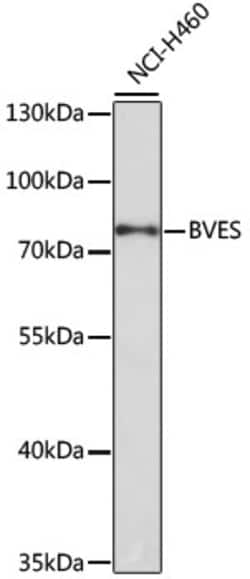 Invitrogen BVES Polyclonal Antibody 100 &mu;L | Buy Online | Invitrogen&trade; | Fisher Scientific