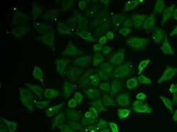 Invitrogen KNP-I Polyclonal Antibody 100 μL; Unconjugated:Antibodies,