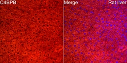 Invitrogen C4BPB Polyclonal Antibody 100 μL; Unconjugated:Antibodies,