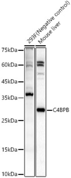 Invitrogen C4BPB Polyclonal Antibody 100 μL; Unconjugated:Antibodies,