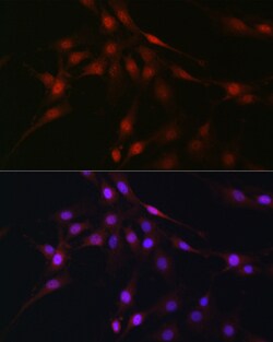 Invitrogen C9orf72 Polyclonal Antibody 100 &mu;L; Unconjugated:Antibodies,