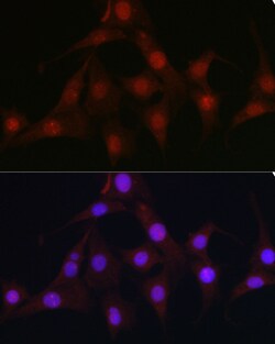 Invitrogen C9orf72 Polyclonal Antibody 100 &mu;L; Unconjugated:Antibodies,