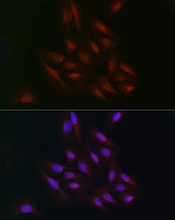 Invitrogen C9orf72 Polyclonal Antibody 100 &mu;L; Unconjugated:Antibodies,