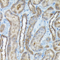 Invitrogen C9orf72 Polyclonal Antibody 100 &mu;L; Unconjugated:Antibodies,