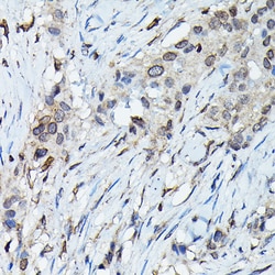 Invitrogen C9orf72 Polyclonal Antibody 100 &mu;L; Unconjugated:Antibodies,