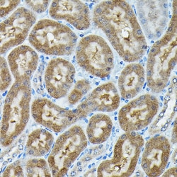 Invitrogen C9orf72 Polyclonal Antibody 100 &mu;L; Unconjugated:Antibodies,