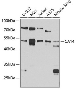Invitrogen CA14 Polyclonal Antibody 100 &mu;L; Unconjugated:Antibodies,