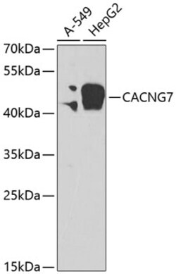 CACNG7 Polyclonal Antibody:Antibodies, Polyclonal