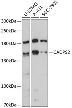 Invitrogen CADPS2 Polyclonal Antibody 100 &mu;L; Unconjugated:Antibodies,