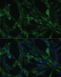 Invitrogen CALU Polyclonal Antibody 100 μL; Unconjugated:Antibodies,