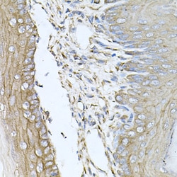 Invitrogen CALU Polyclonal Antibody 100 μL; Unconjugated:Antibodies,