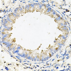 Invitrogen CALU Polyclonal Antibody 100 μL; Unconjugated:Antibodies,