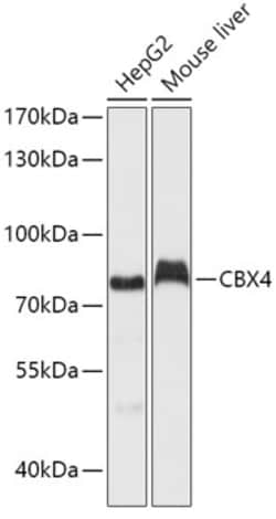 Invitrogen CBX4 Polyclonal Antibody 100 μL; Unconjugated:Antibodies,