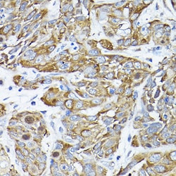 Invitrogen CC2D1A Polyclonal Antibody 100 &mu;L; Unconjugated:Antibodies,