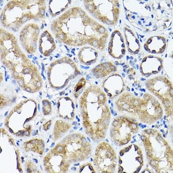 Invitrogen CC2D1A Polyclonal Antibody 100 &mu;L; Unconjugated:Antibodies,