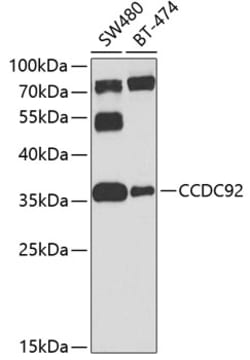 Invitrogen CCDC92 Polyclonal Antibody 100 &mu;L; Unconjugated:Anticuerpos