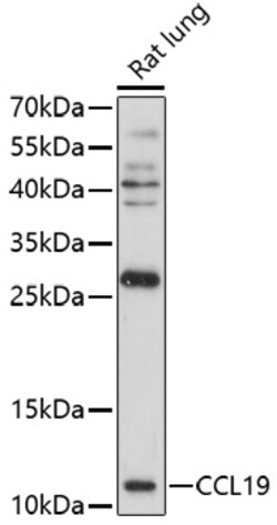 Invitrogen CCL19 Polyclonal Antibody 100 &mu;L; Unconjugated:Antibodies,