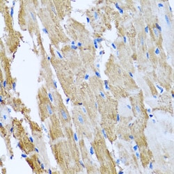 Invitrogen CCM2 Polyclonal Antibody 100 &mu;L | Buy Online | Invitrogen&trade; | Fisher Scientific