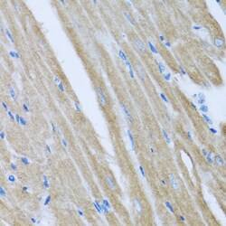 Invitrogen CCM2 Polyclonal Antibody 100 &mu;L | Buy Online | Invitrogen&trade; | Fisher Scientific