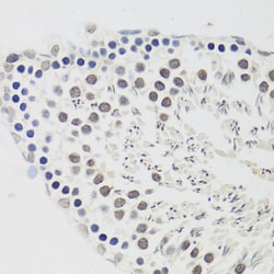 Invitrogen Cyclin E2 Polyclonal Antibody 100 &mu;L; Unconjugated:Antibodies,