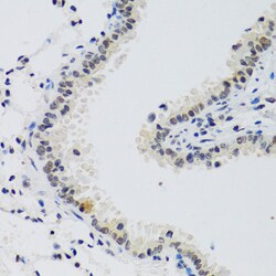 Invitrogen Cyclin E2 Polyclonal Antibody 100 &mu;L; Unconjugated:Antibodies,