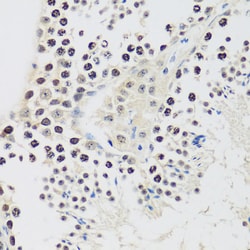 Invitrogen Cyclin E2 Polyclonal Antibody 100 &mu;L; Unconjugated:Antibodies,