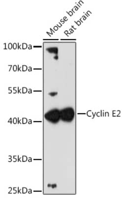 Invitrogen Cyclin E2 Polyclonal Antibody 100 &mu;L; Unconjugated:Antibodies,
