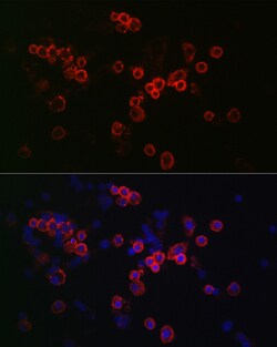 Invitrogen CCR7 Polyclonal Antibody 100 &mu;L; Unconjugated:Antibodies,