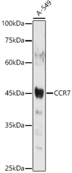 Invitrogen CCR7 Polyclonal Antibody 100 &mu;L; Unconjugated:Antibodies,