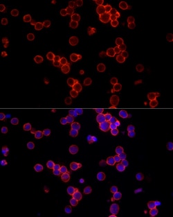 Invitrogen CD19 Polyclonal Antibody 100 μL; Unconjugated:Antibodies,
