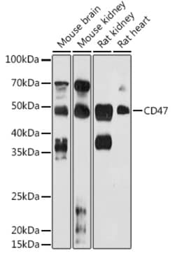 Invitrogen CD47 Polyclonal Antibody 100 &mu;L; Unconjugated:Anticuerpos