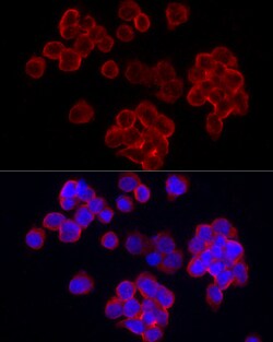 CD70 Polyclonal Antibody, Invitrogen 100 &mu;L; Unconjugated:Antibodies,