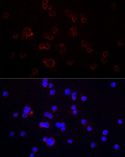 CD70 Polyclonal Antibody, Invitrogen 100 &mu;L; Unconjugated:Antibodies,