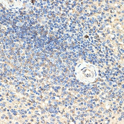 CD70 Polyclonal Antibody, Invitrogen 100 &mu;L; Unconjugated:Antibodies,