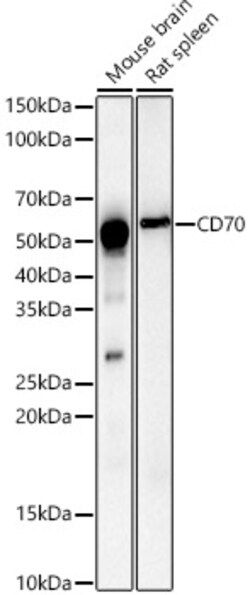 CD70 Polyclonal Antibody, Invitrogen 100 &mu;L; Unconjugated:Antibodies,