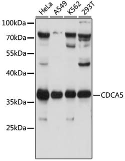 Invitrogen CDCA5 Polyclonal Antibody 100 μL; Unconjugated:Antibodies,