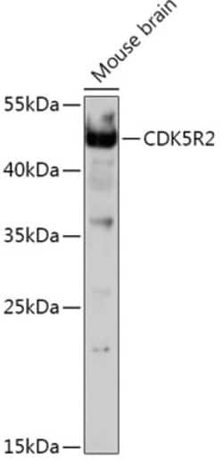 Invitrogen p39 Polyclonal Antibody 100 &mu;L; Unconjugated:Antibodies,