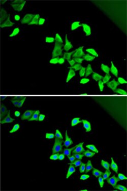 Invitrogen CDKAL1 Polyclonal Antibody 100 &mu;L; Unconjugated:Antibodies,