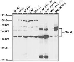 Invitrogen CDKAL1 Polyclonal Antibody 100 &mu;L; Unconjugated:Antibodies,