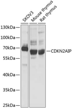 Invitrogen CDKN2AIP Polyclonal Antibody 100 &mu;L; Unconjugated:Antibodies,