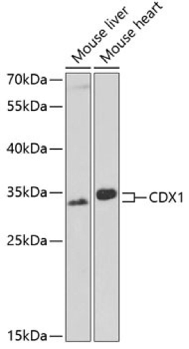 CDX1 Rabbit anti-Human, Mouse, Unconjugated, Polyclonal, Invitrogen 100 ...